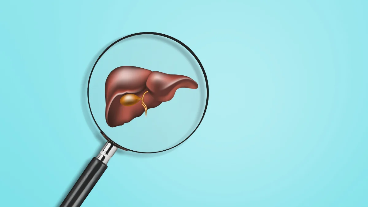 Liver Cirrhosis Treatment in Chennai