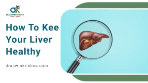 How to Keep Your Liver Healthy
