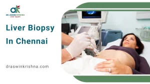 Liver Biopsy in Chennai