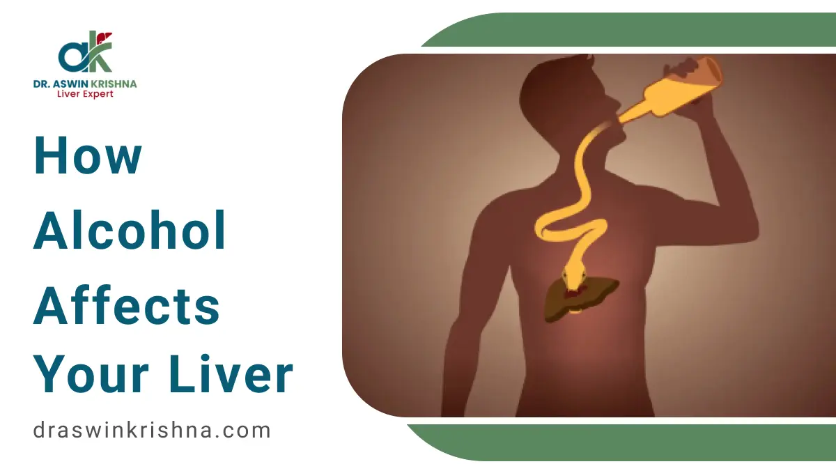 How Alcohol Affects Your Liver