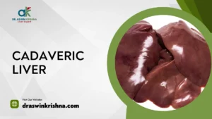 cadaveric liver transplant