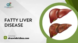 Fatty Liver Disease