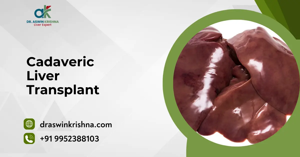 Cadaveric Liver Transplant