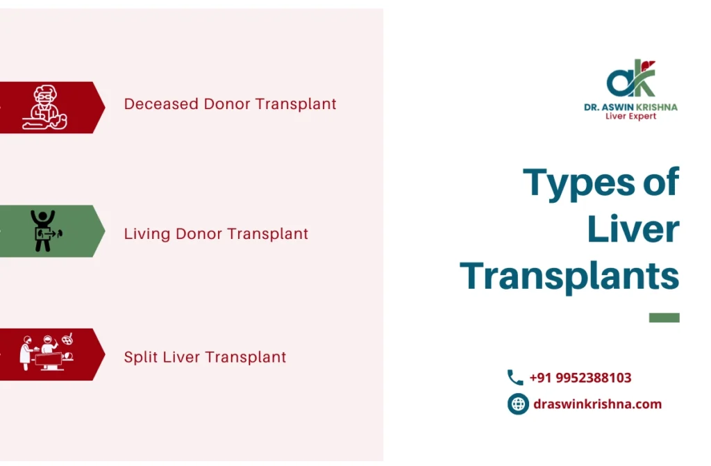 liver transplant facts