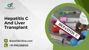 Hepatitis C And Liver Transplant