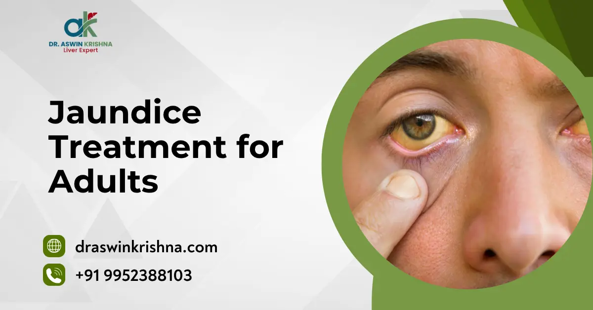 Jaundice Treatment for Adults