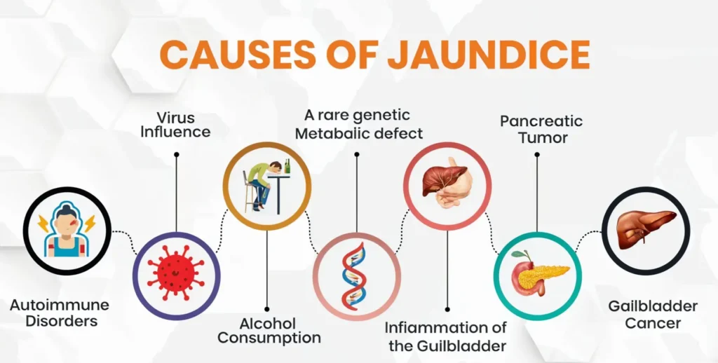 Jaundice Treatment for Adults