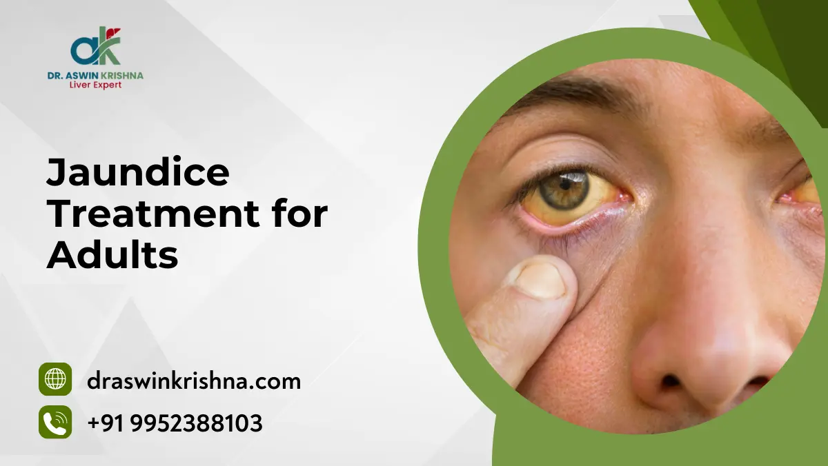 Jaundice Treatment for Adults