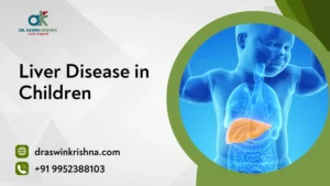 Liver Disease in Children