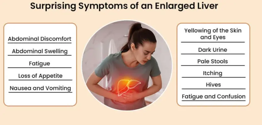 Treatment for Enlarged Liver