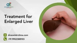 Treatment for Enlarged Liver