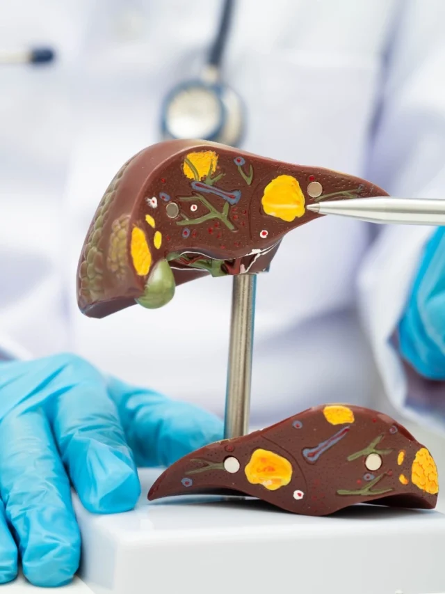 Cadaveric Liver
