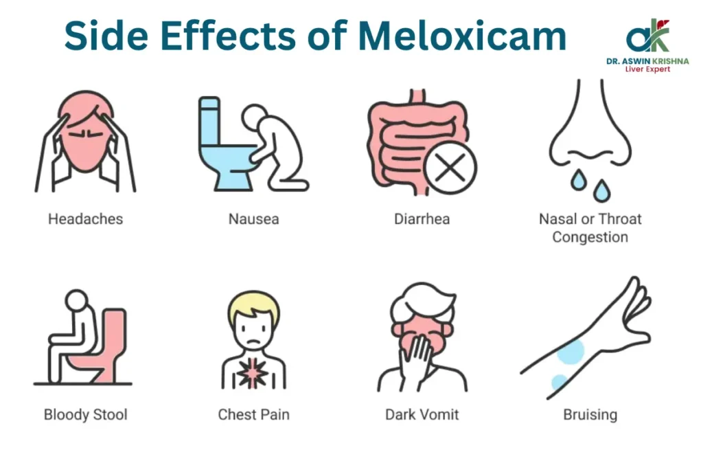 Side Effects of Meloxicam