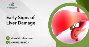Early Signs of Liver Damage