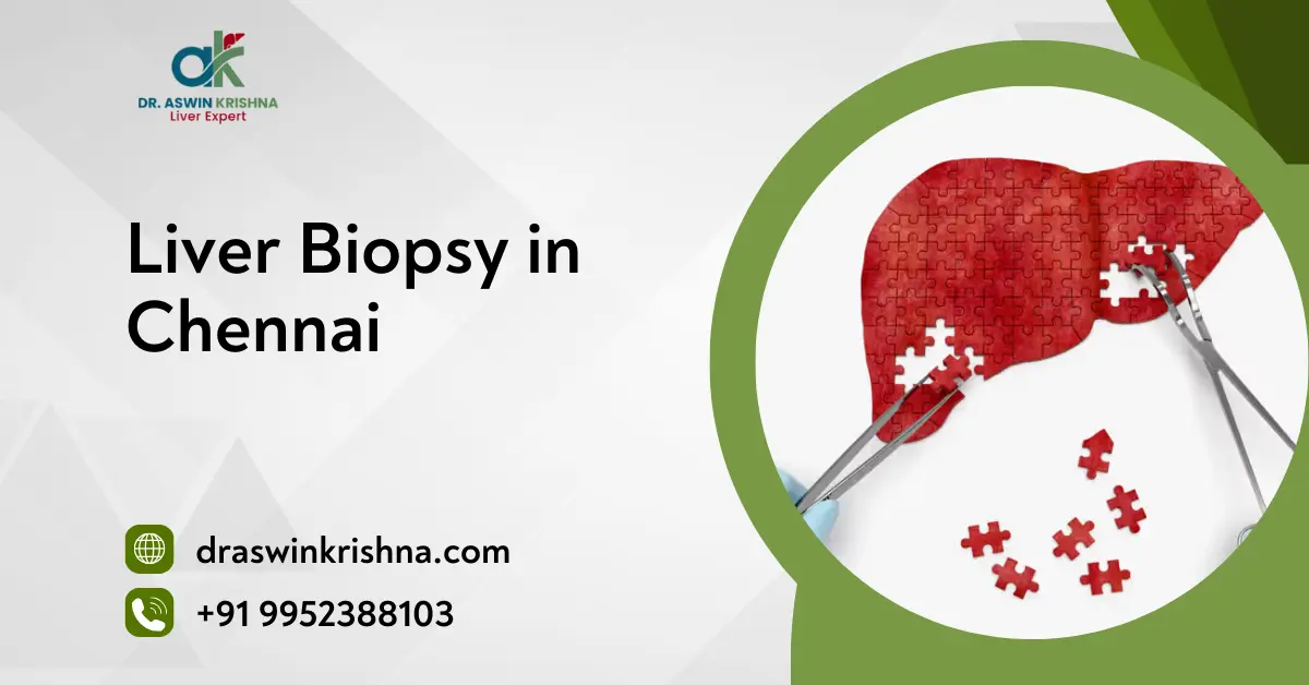Liver Biopsy in Chennai
