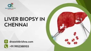Liver Biopsy in Chennai