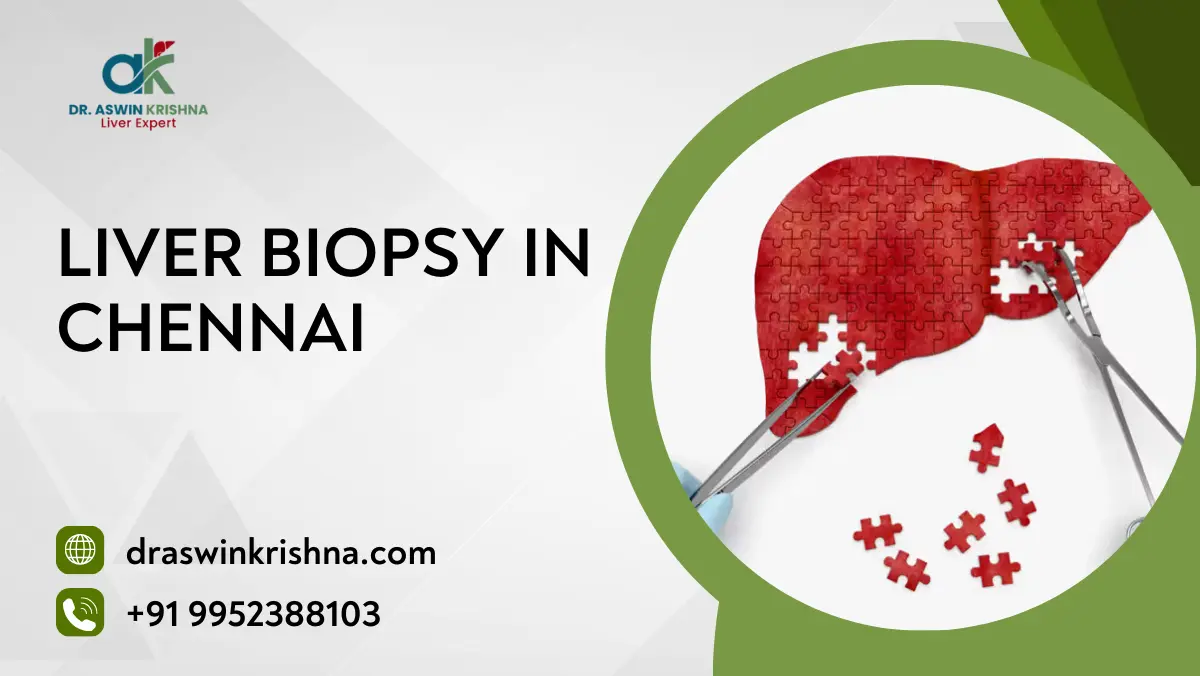 Liver Biopsy in Chennai