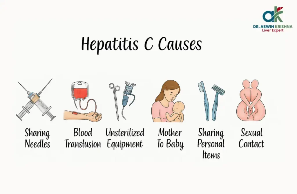Hepatitis C Treatment in Chennai