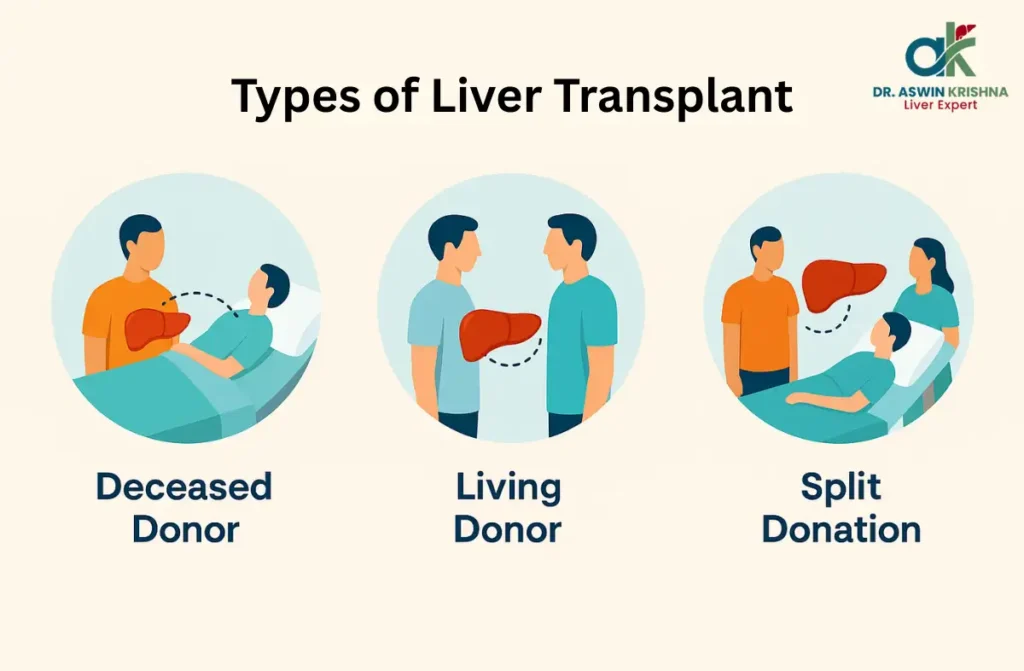 Liver Transplant Process