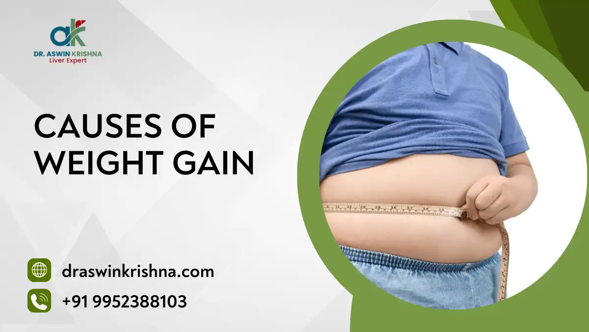 Causes of Weight Gain