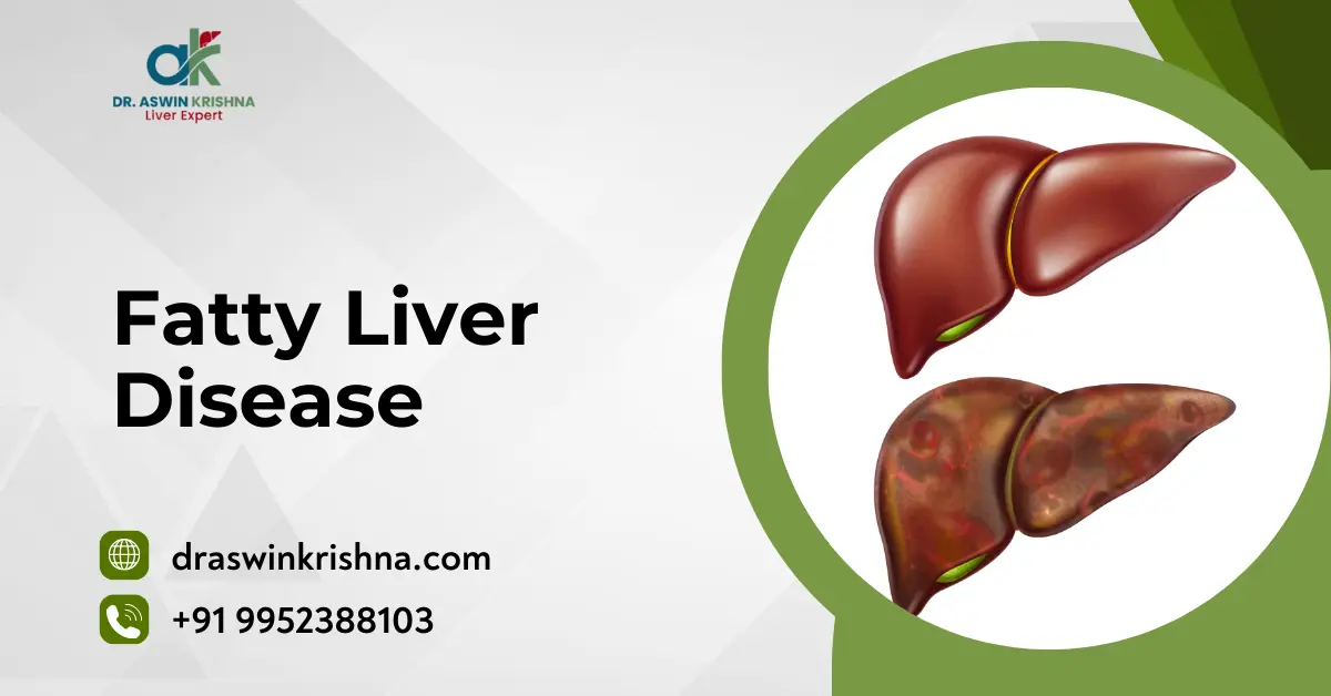 Fatty Liver Disease