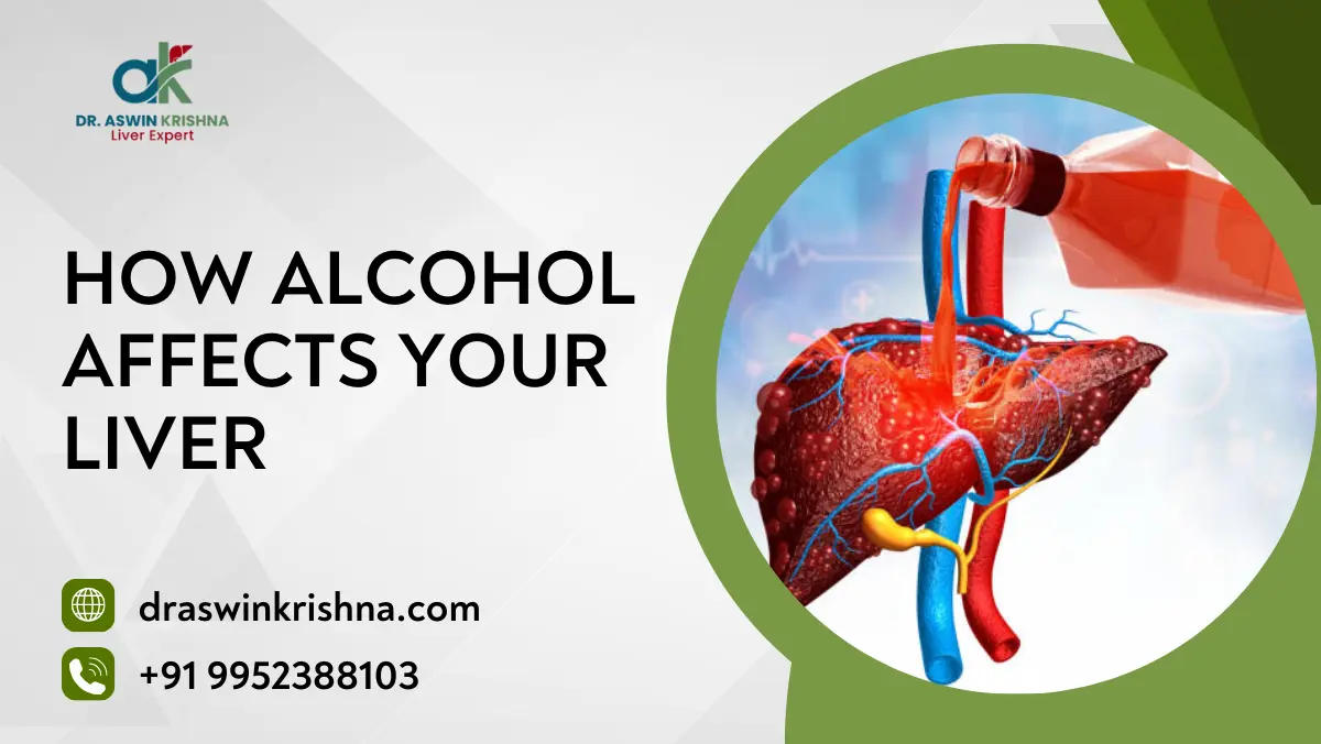 How Alcohol Affects Your Liver