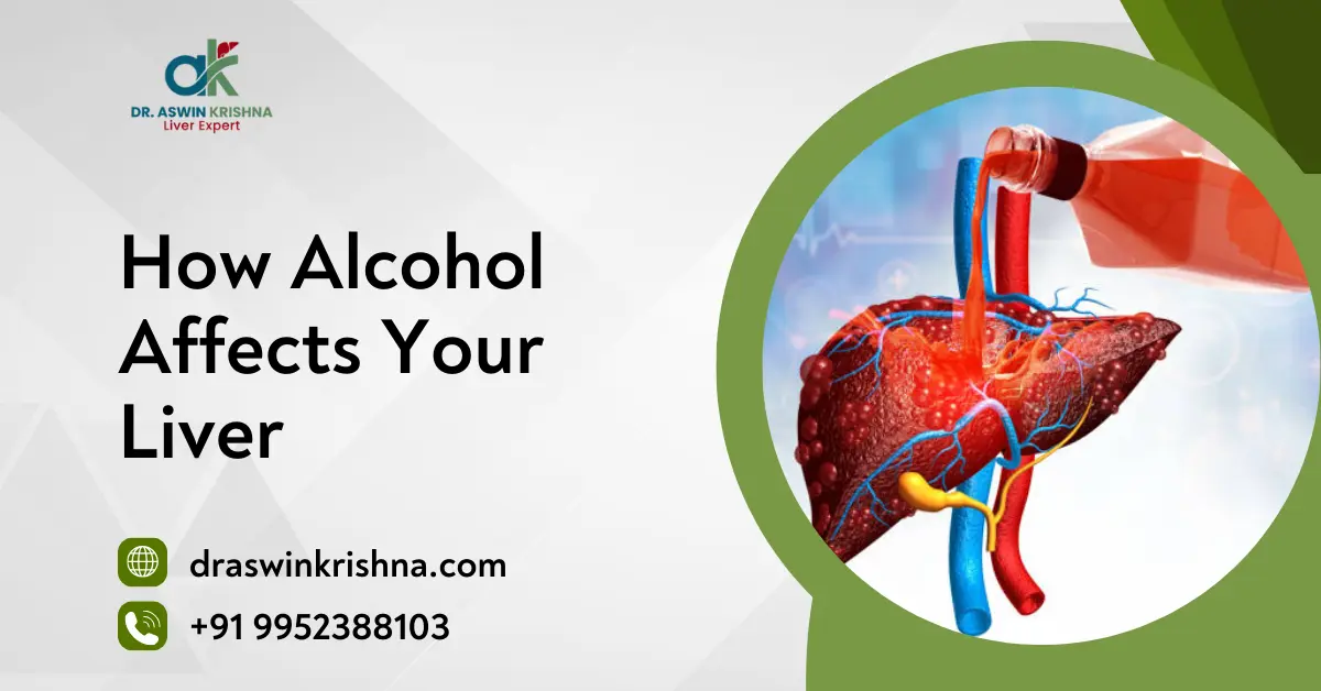 How Alcohol Affects Your Liver