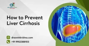 How to Prevent Liver Cirrhosis