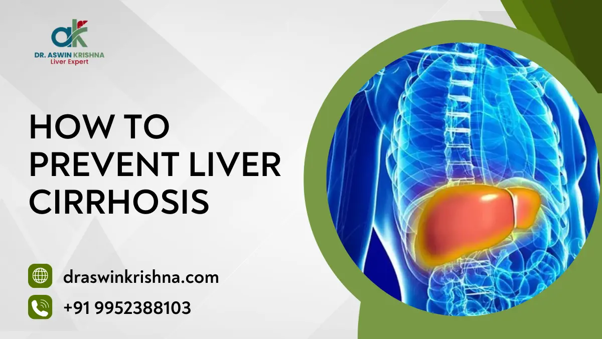 How to Prevent Liver Cirrhosis
