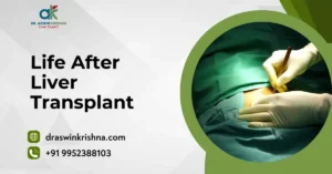 Life After Liver Transplant