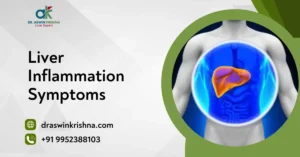 Liver Inflammation Symptoms