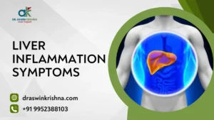 Liver Inflammation Symptoms