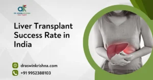 Liver Transplant Success Rate In India
