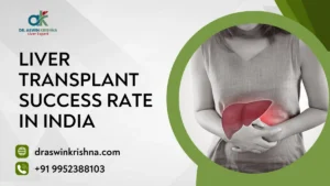 Liver Transplant Success Rate In India