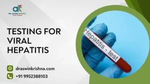 Testing for Viral Hepatitis