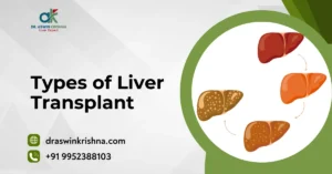 Types Of Liver Transplant