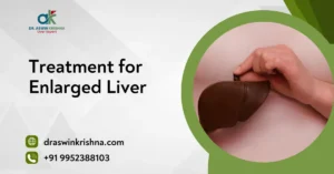 Treatment for Enlarged Liver