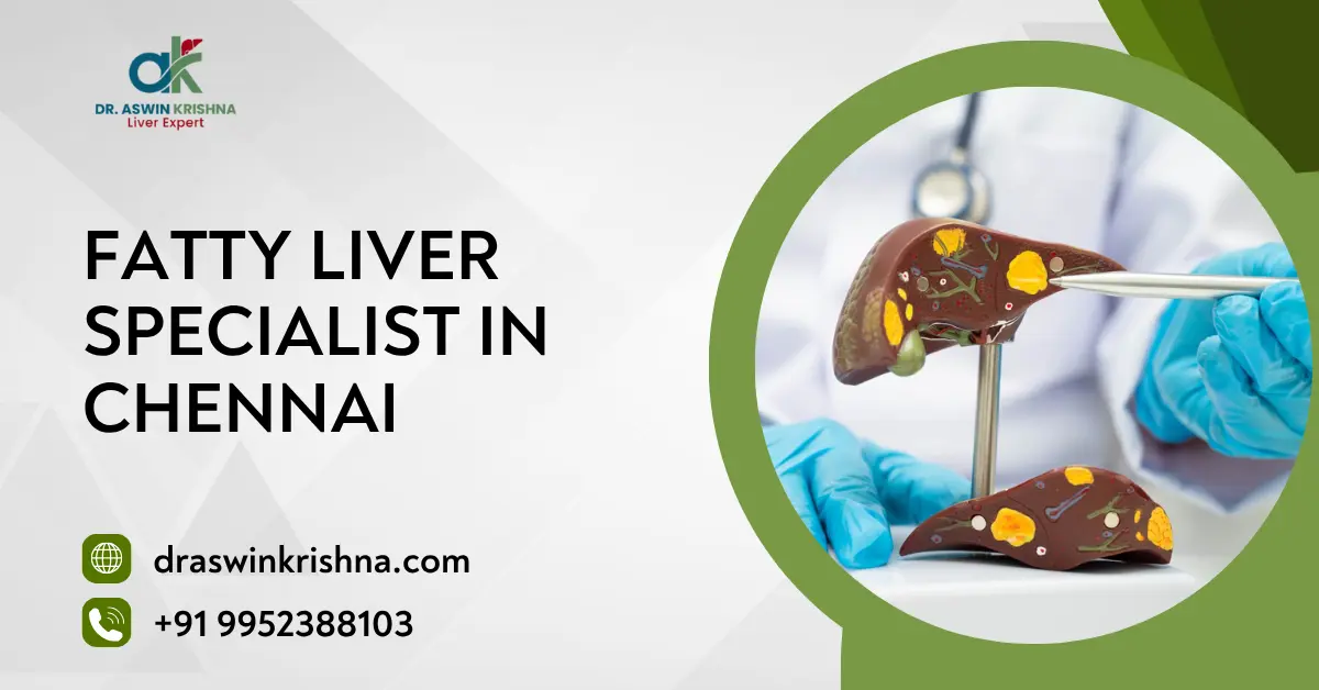 Fatty Liver Specialist in Chennai
