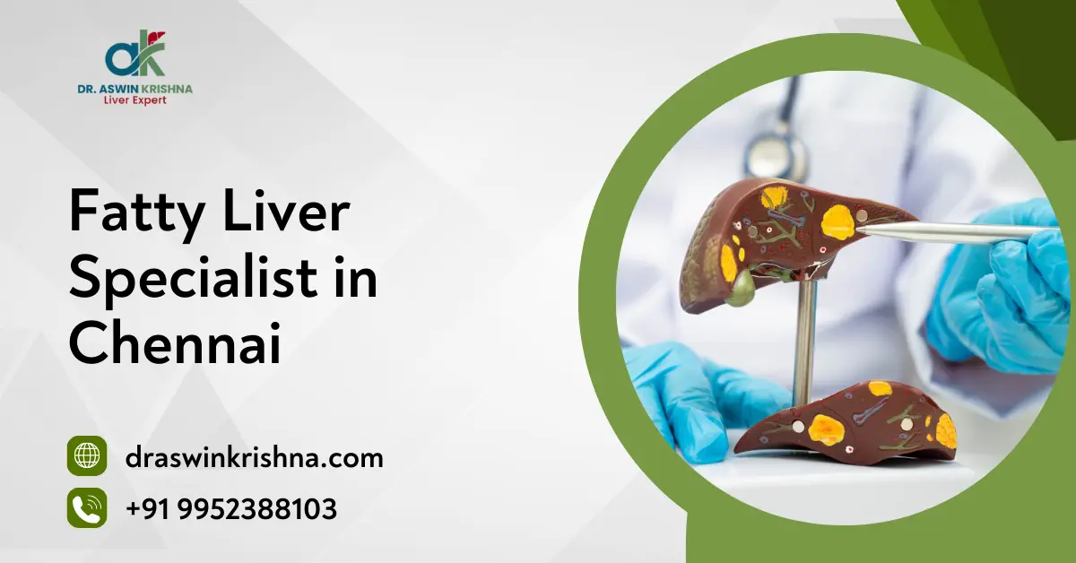 Fatty Liver Specialist in Chennai