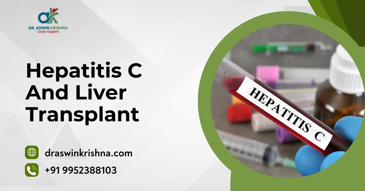 Hepatitis C And Liver Transplant