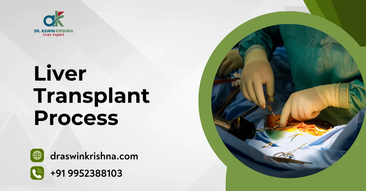 Liver Transplant Process