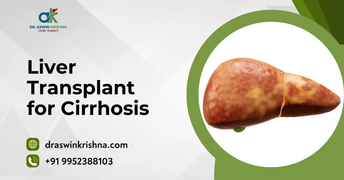 Liver Transplant For Cirrhosis